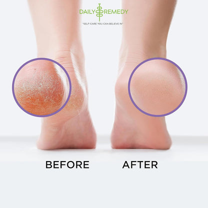 TREAT YOUR FEET Calming Lavender Foot Soak with Epsom Salt - 2 PACK - Soothes Sore Tired Feet, Athletes Foot & Remove Foot Odor