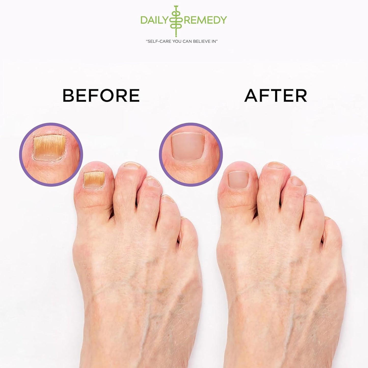 TREAT YOUR FEET Calming Lavender Foot Soak with Epsom Salt - 2 PACK - Soothes Sore Tired Feet, Athletes Foot & Remove Foot Odor