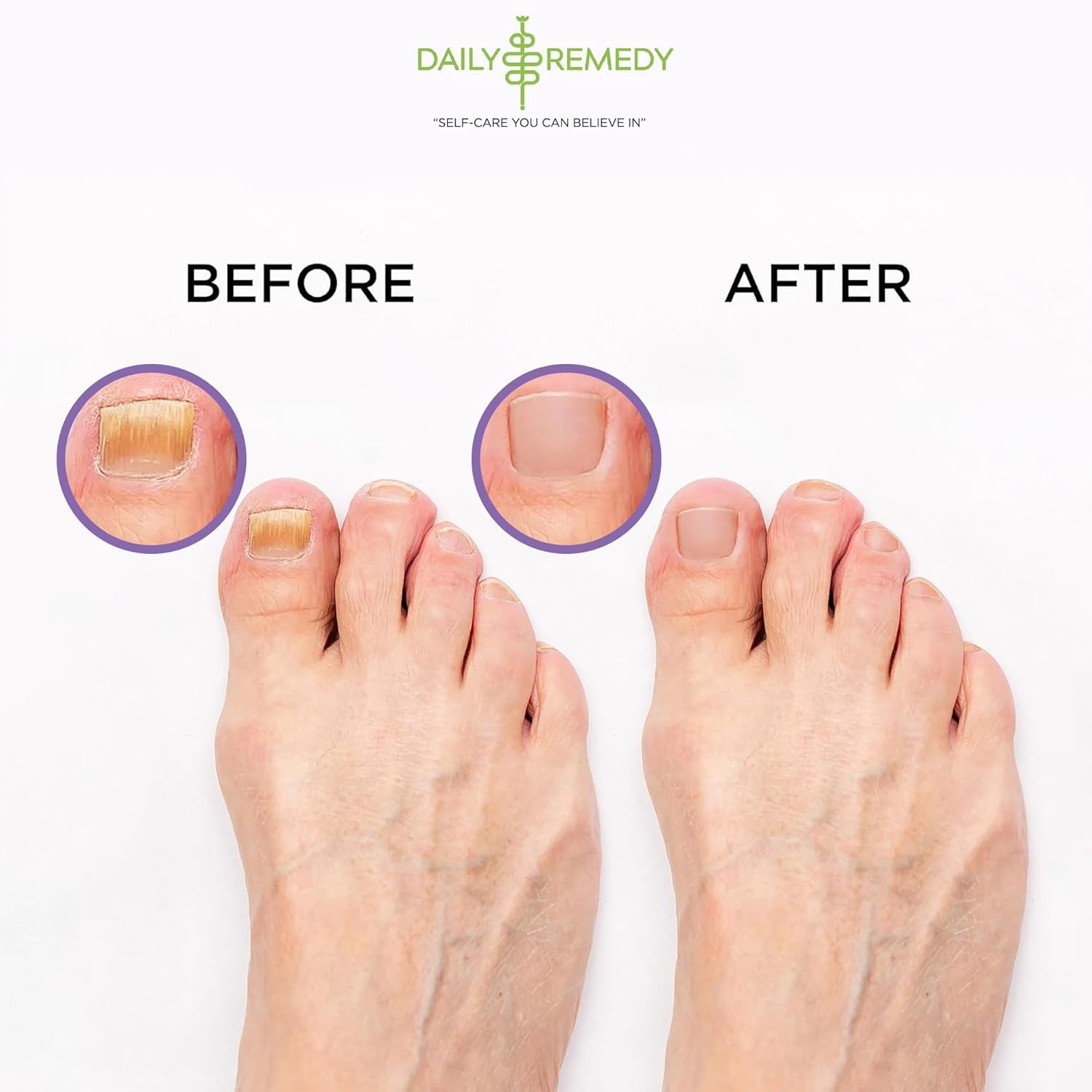 TREAT YOUR FEET Calming Lavender Foot Soak with Epsom Salt - 2 PACK - Soothes Sore Tired Feet, Athletes Foot & Remove Foot Odor