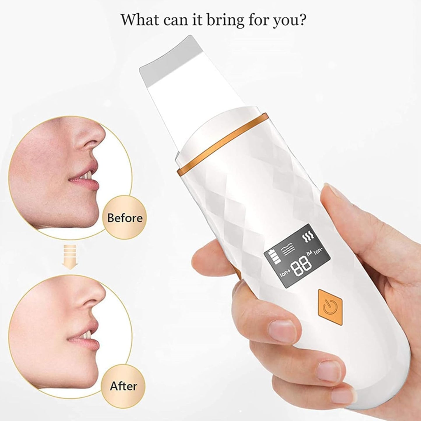 SPA DAY ESSENTIALS Skin Scrubber Face Spatula | LCD Screen Dead Skin Scraper / Blackhead Removal | Ultrasonic Pore Extractor - 4 Modes