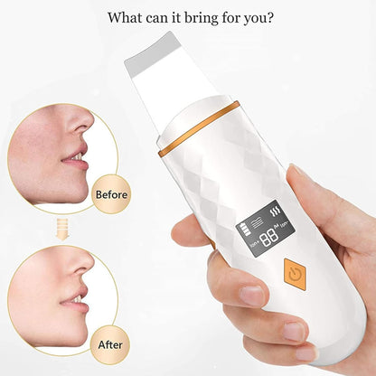 SPA DAY ESSENTIALS Skin Scrubber Face Spatula | LCD Screen Dead Skin Scraper / Blackhead Removal | Ultrasonic Pore Extractor - 4 Modes